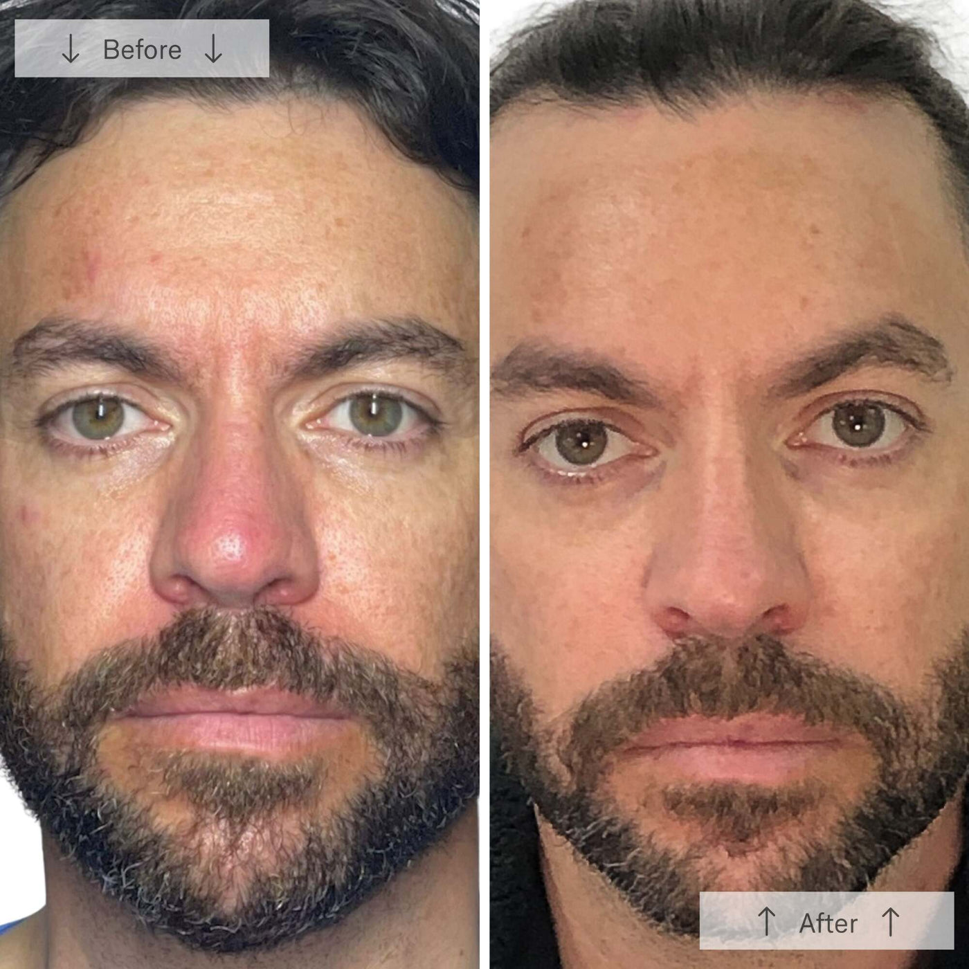 Omnilux Men - Image 8